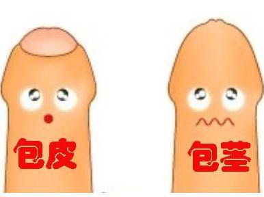包皮过长症状,包皮过长表现,包皮过长病因,包皮过长预防,包皮过长检查,包皮过长危害